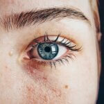 Skin Cancer Awareness Month: Protecting Your Skin is a Lifestyle
